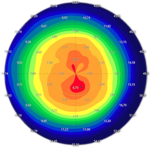 Esame della Topografia Corneale